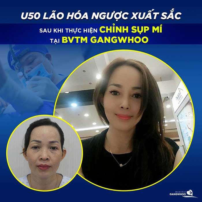 Học Cắt Mí & Bấm Mí, Thẩm Mỹ Mắt Ở Đâu?