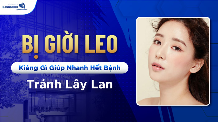 Bị giời leo kiêng gì?