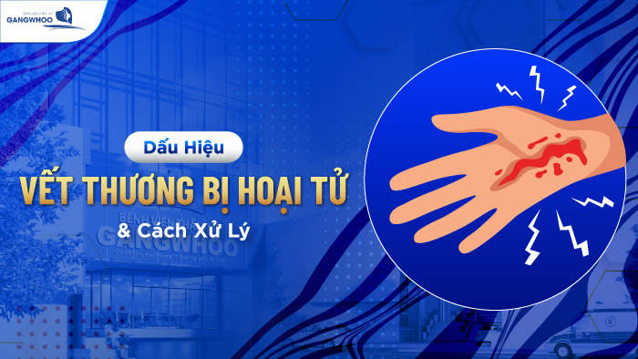Dấu hiệu vết thương bị hoại tử