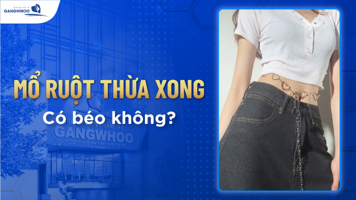 Mổ ruột thừa xong có béo không?