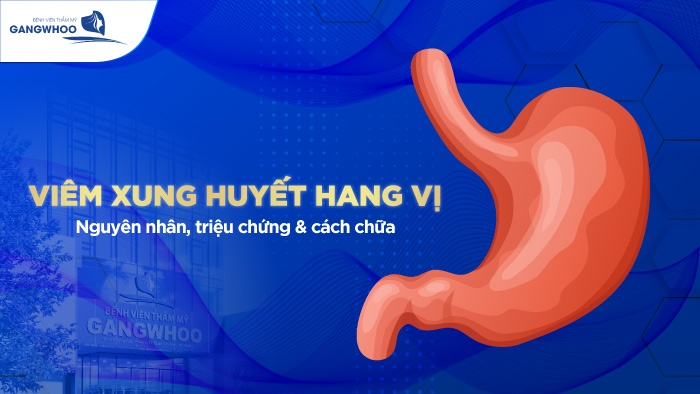 Viêm xung huyết hang vị là gì?