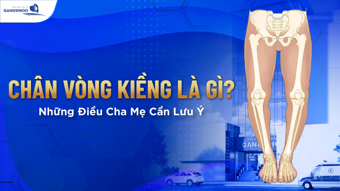 Chân vòng kiềng là gì?