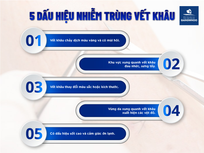 5 dấu hiệu nhiễm trùng vết khâu mà bạn nên đề phòng