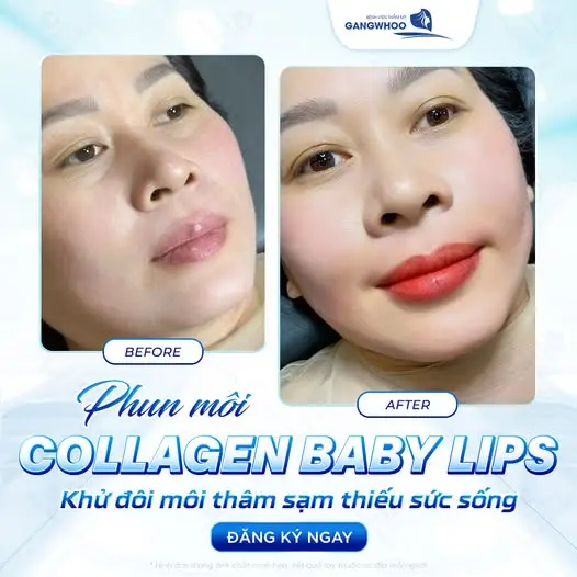 Phun môi Aqualip là kỹ thuật phun xăm thẩm mỹ