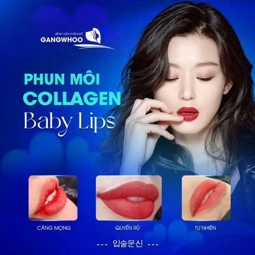 Phun môi candy lips là gì? Những điều bạn cần biết